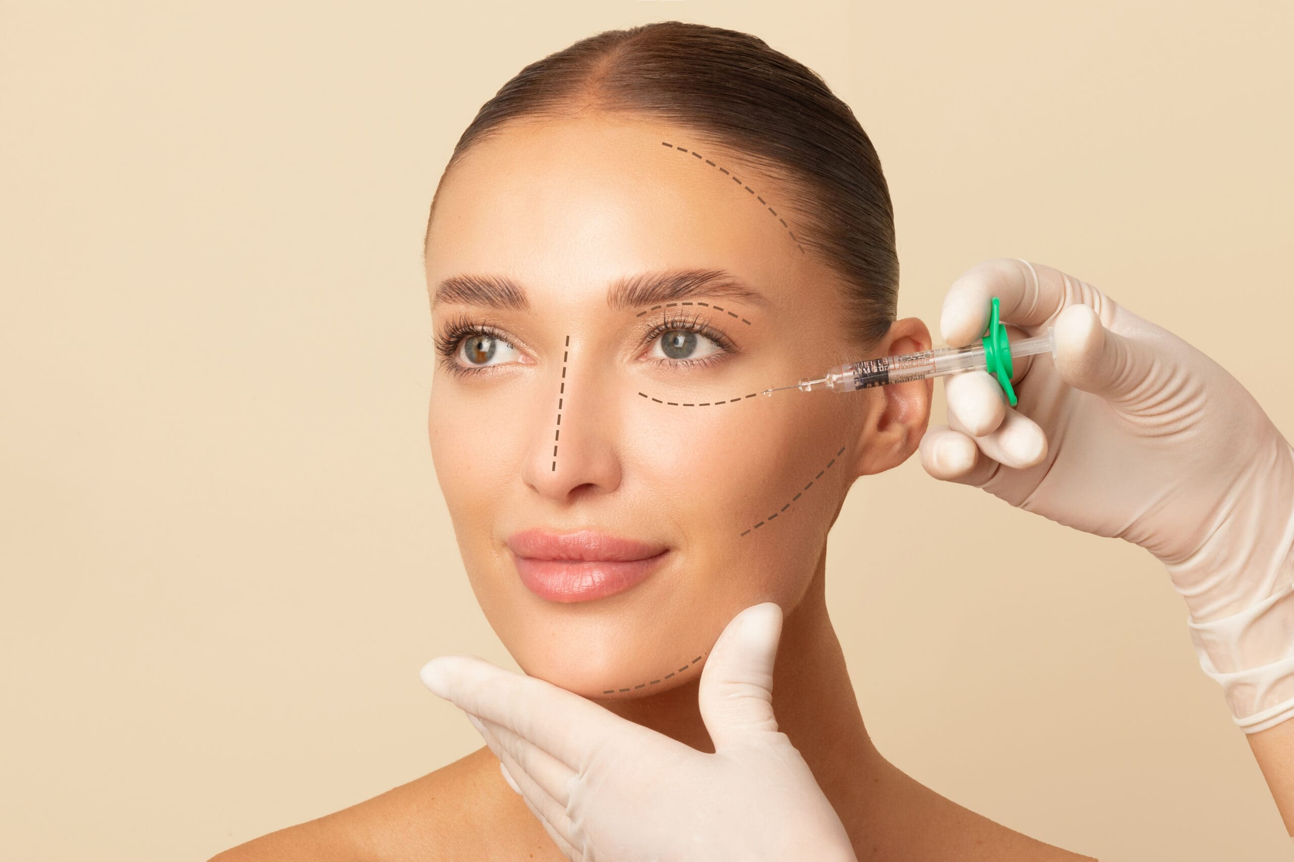 A woman with marked lines on her face receives a cosmetic injection near her cheek. A gloved hand gently holds her chin while another administers the syringe. The background is a soft beige color.
